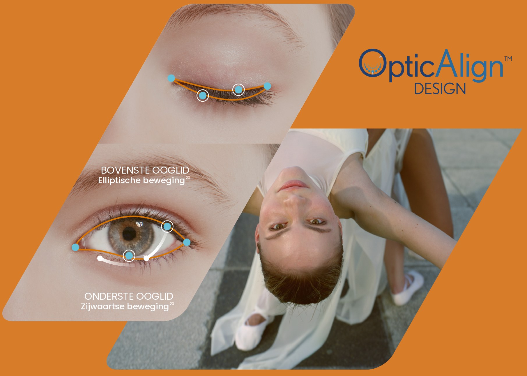 OpticAlign Design – bovenste en onderste ooglid